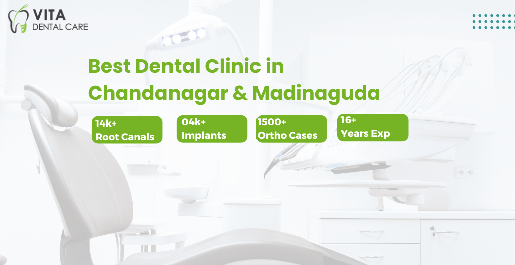 Best Dental Clinic in  Chandanagar & Madinaguda 
