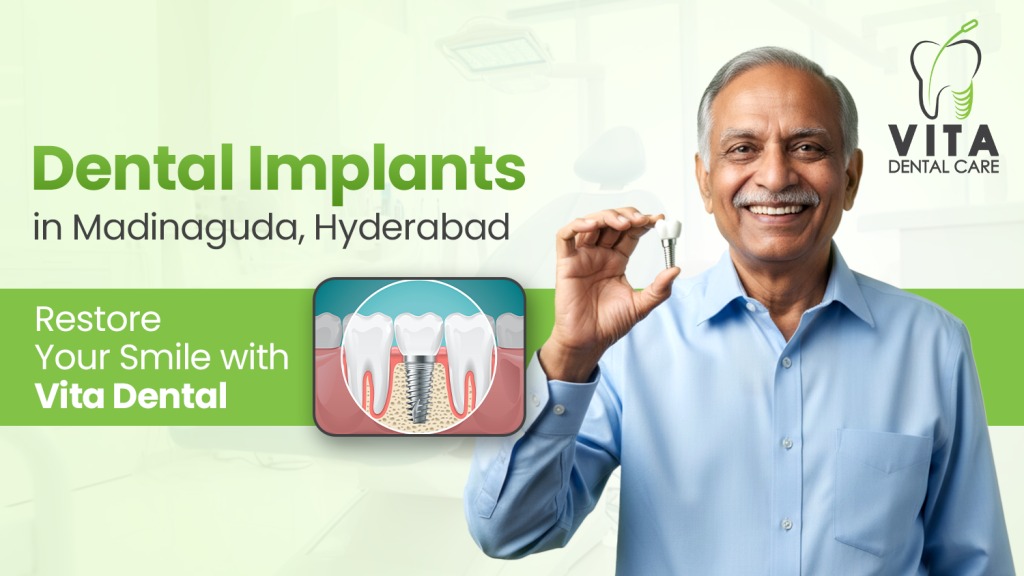 dental implants in Madinaguda